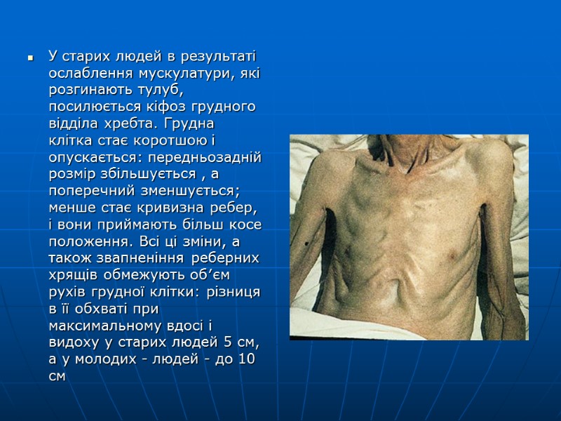 У старих людей в результаті  ослаблення мускулатури, які розгинають тулуб, посилюється кіфоз грудного